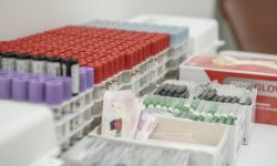 Testul ALEX pentru depistarea cauzei alergiei! 3 motive de bază de ce trebuie să îl faci!