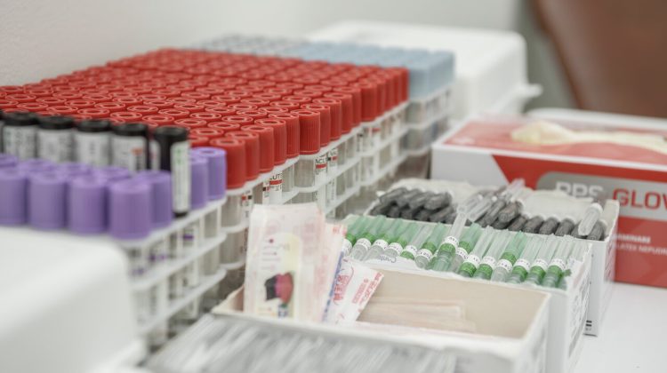 Testul ALEX pentru depistarea cauzei alergiei! 3 motive de bază de ce trebuie să îl faci!